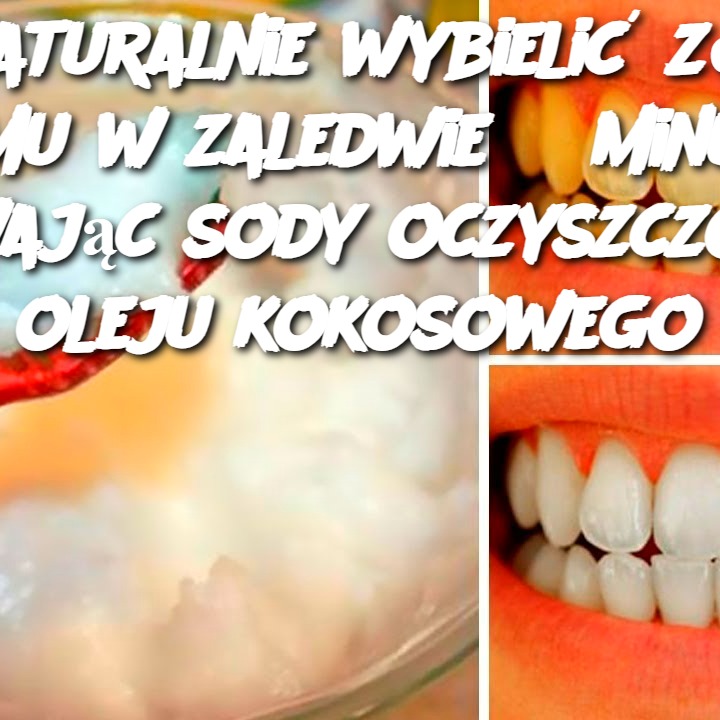 Jak naturalnie wybielić zęby w domu w zaledwie 3 minuty, używając sody oczyszczonej i oleju kokosowego