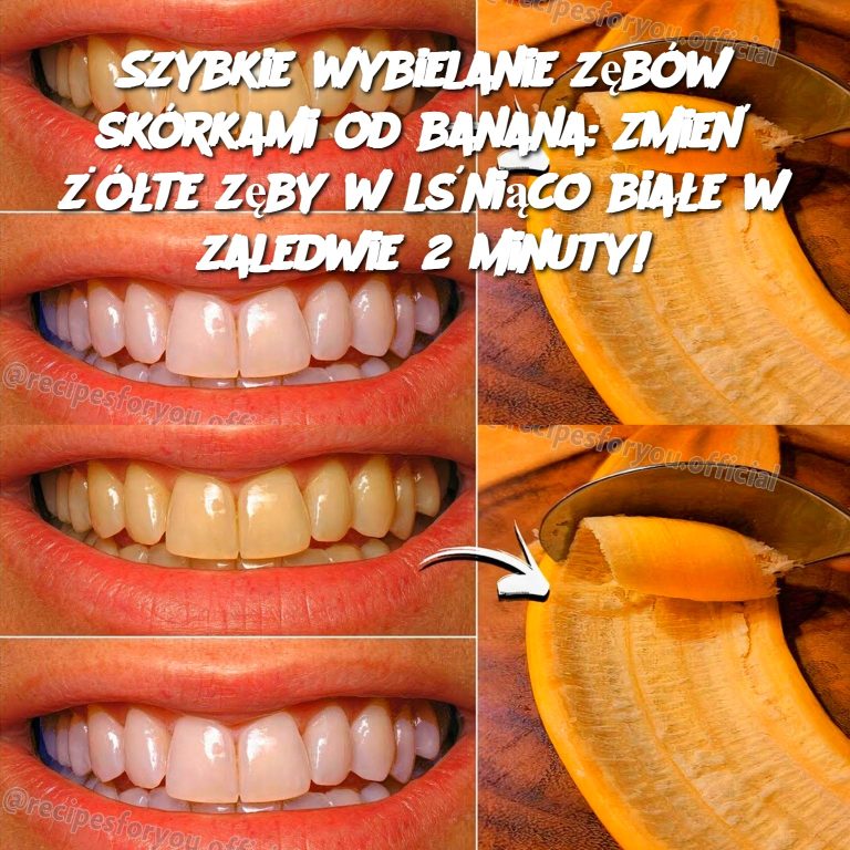 Szybkie wybielanie zębów skórkami od banana: Zmień żółte zęby w lśniąco białe w zaledwie 2 minuty!