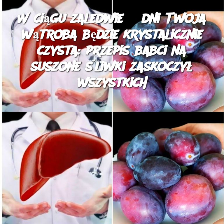 W ciągu zaledwie 3 dni Twoja wątroba będzie krystalicznie czysta: przepis babci na suszone śliwki zaskoczył wszystkich