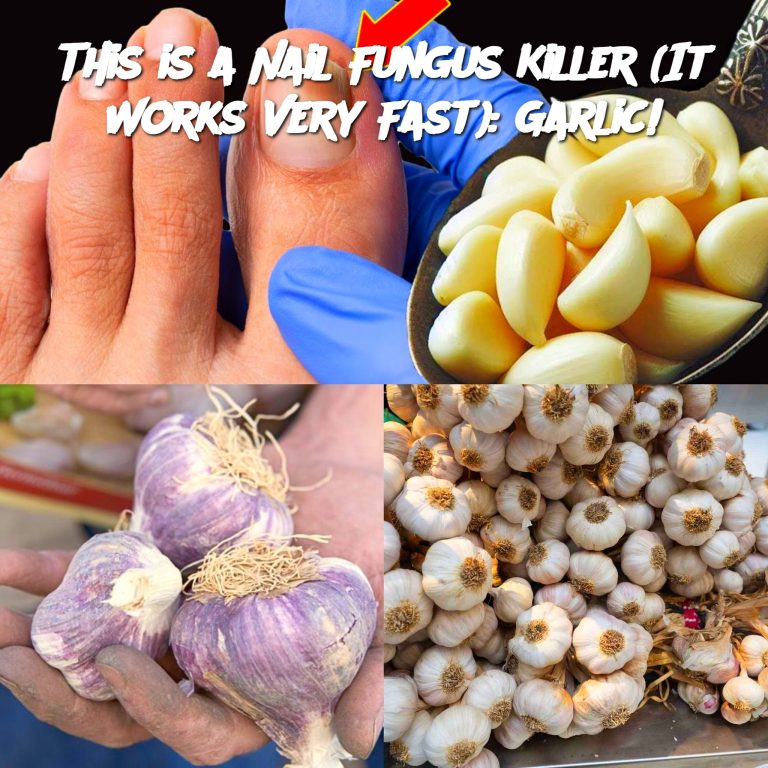 This is a Nail Fungus Killer (It Works Very Fast): Garlic!