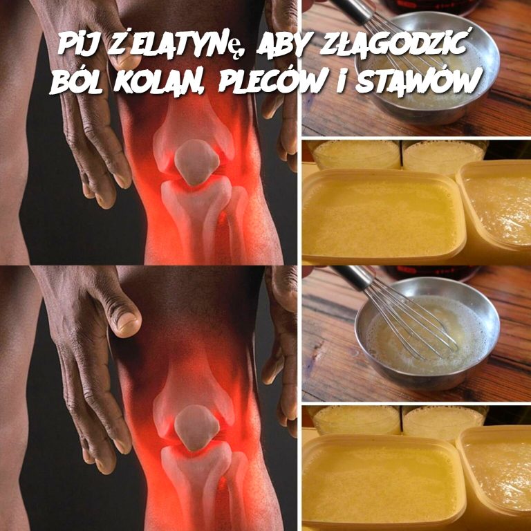 Pij żelatynę, aby złagodzić ból kolan, pleców i stawów