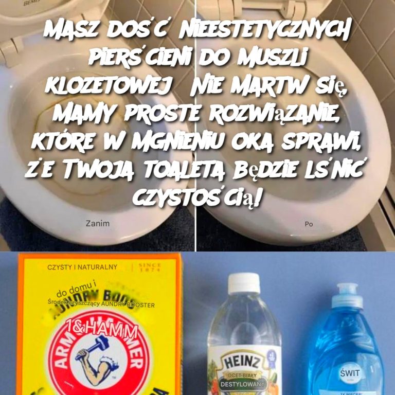 Masz dość nieestetycznych pierścieni do muszli klozetowej? Nie martw się, mamy proste rozwiązanie, które w mgnieniu oka sprawi, że Twoja toaleta będzie lśnić czystością!