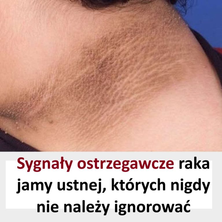 Nie lekceważ tego