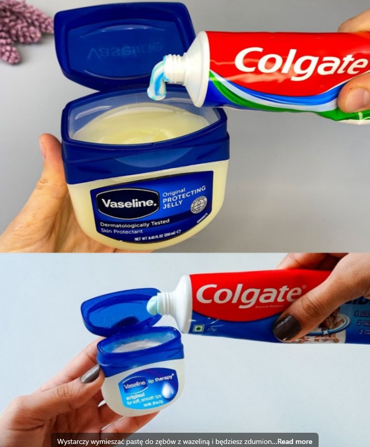 Jak Używać Colgate i Wazeliny, aby Pozbyć Się Ciemnych Plam na Skórze?