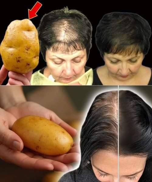 Sekret Szybkiego Wzrostu Włosów: Naturalna Maska Ziemniaczana, Która Zrewolucjonizuje Twoje Włosy!